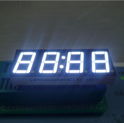 Mikrodalga Fırın Zamanlayıcı, Dijital Saat Ekran için LED Saat Göstergesi